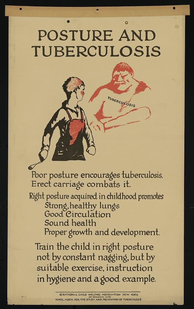 Posture and tuberculosis (1920-01-01)